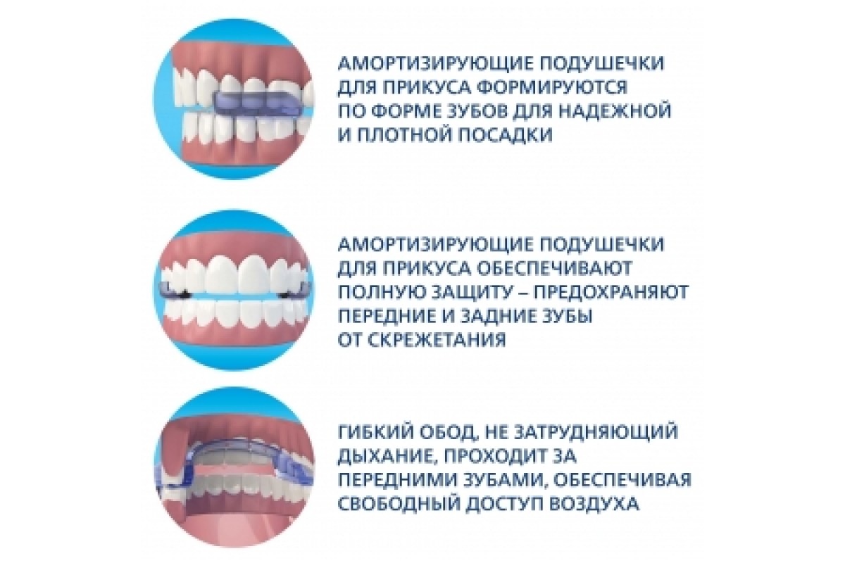 Капы для зубов отзывы. Капа от бруксизма. Защитная Капа при бруксизме. Ротационная зубная Каппа. Зубная Капа для скрежет зубами.