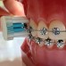 Edel+White Pro-Ortho Ортодонтична зубна щітка жорстка-ультрам'яка біла